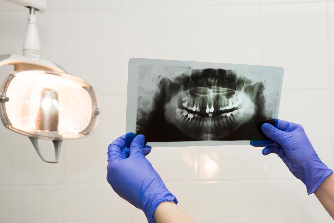 Dentist In Brampton Oral Surgery