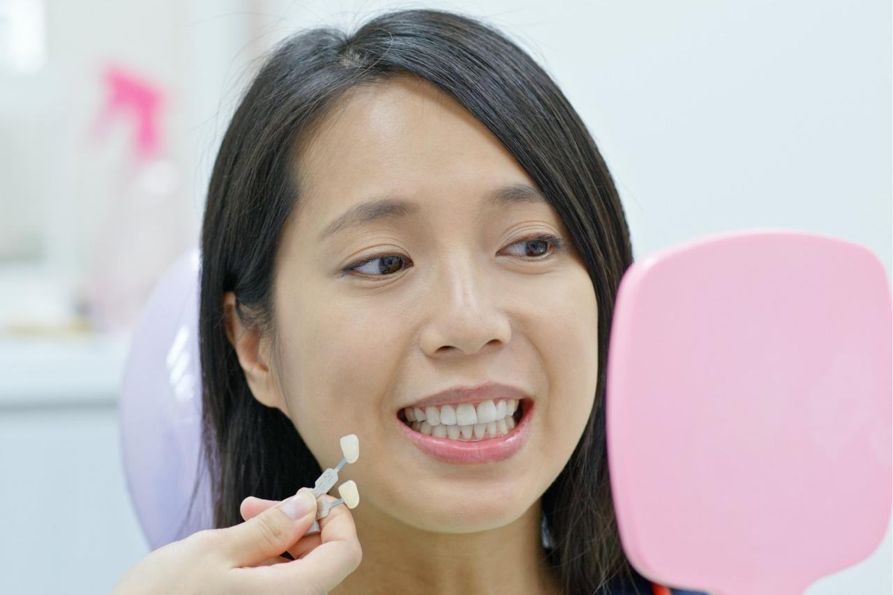 Teeth Whitening- Brampton Dentist