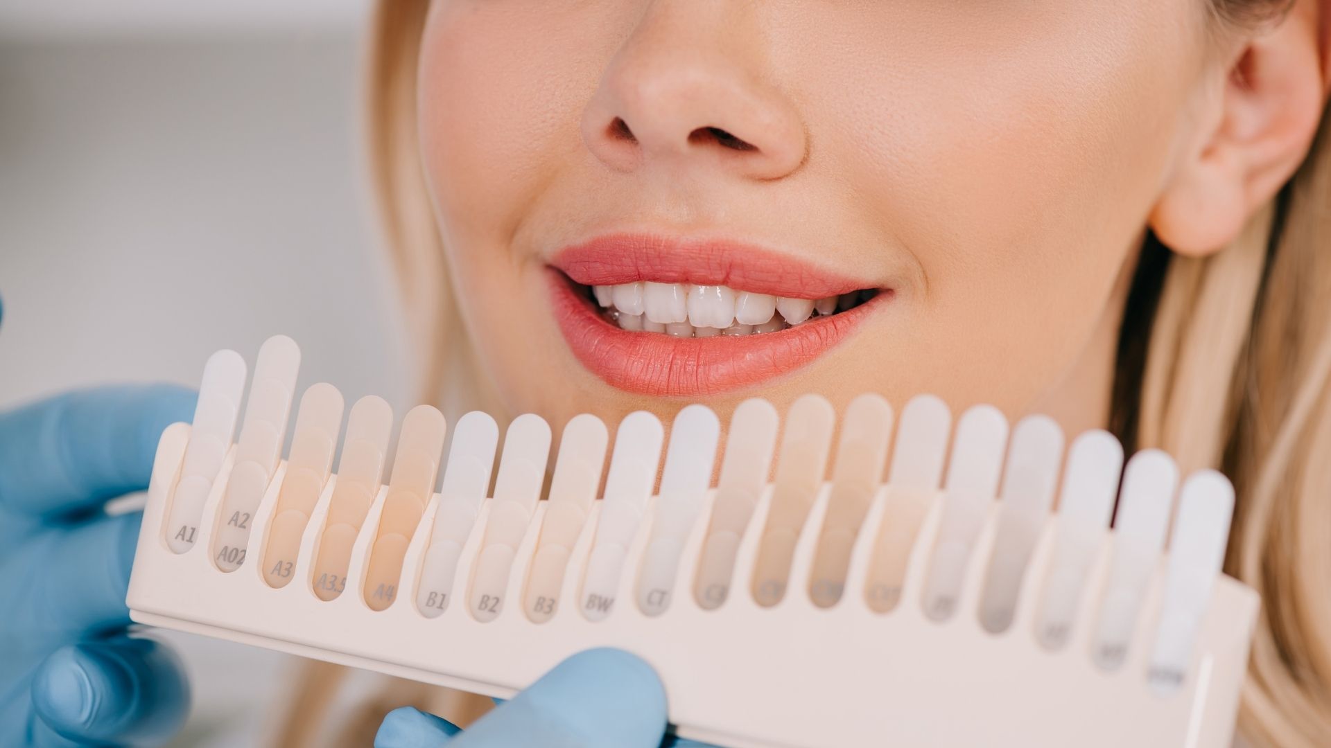 Teeth Whitening Brampton- Dentist In Brampton