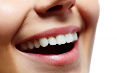 How Much Does Teeth Whitening Cost In Canada – 2022