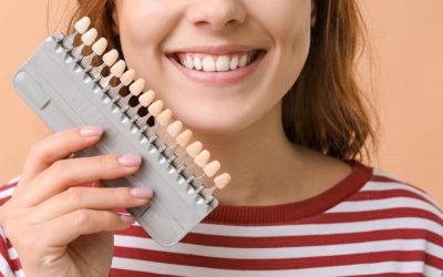 What Are Veneers – How do they help my smile?