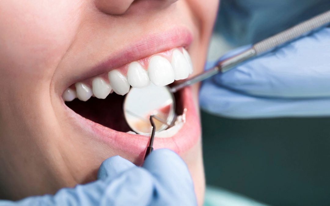 Dentist in Brampton – Visit Your Brampton Dentist Regularly