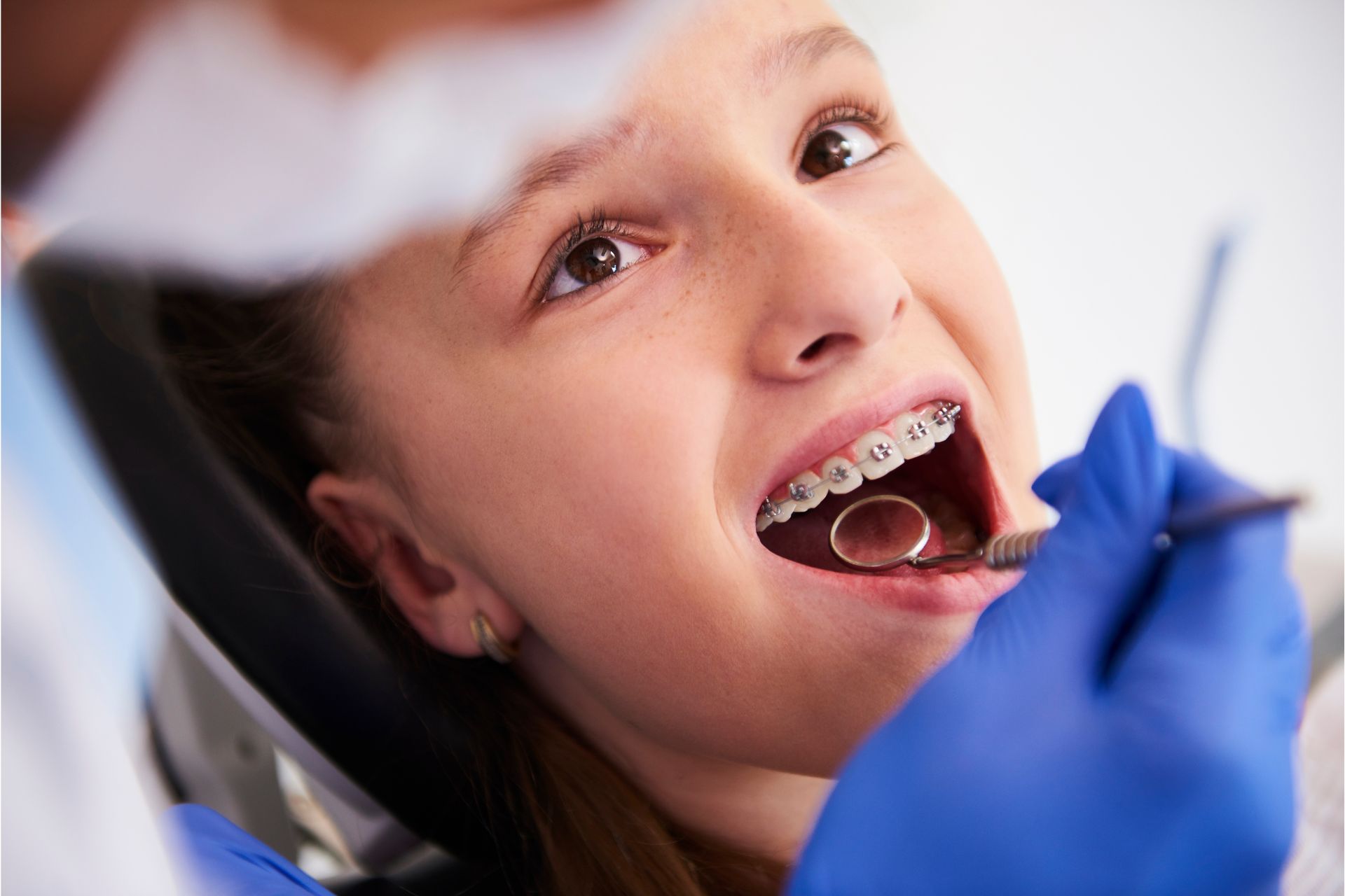 Kids Dentist in Brampton - Brampton Dentist